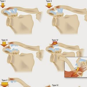 Meet your Posher, Andy